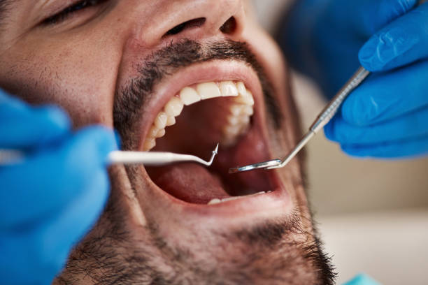 Best Cracked Tooth Emergency Dentist  in Chepachet, RI