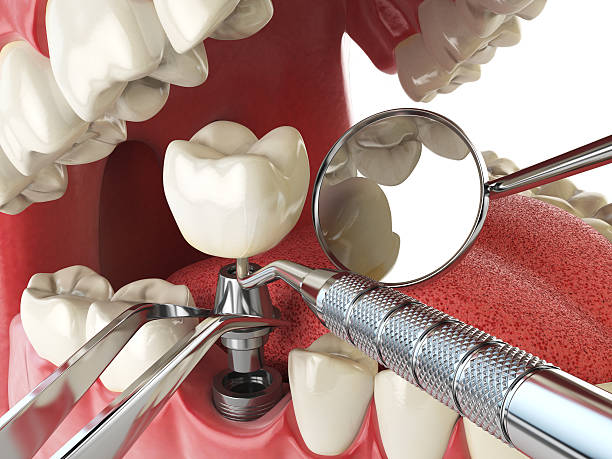 Best Root Canal Emergency Dentist  in Chepachet, RI
